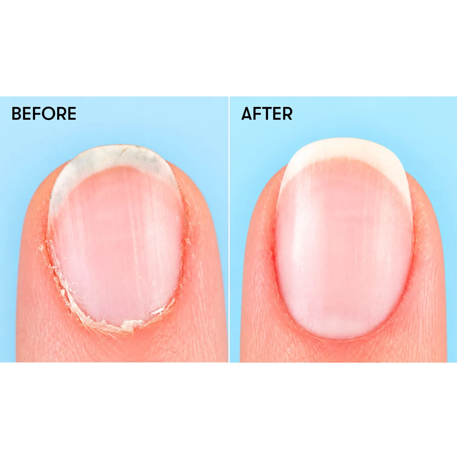 Nails Inc Bye Bye Cuticles Blueberry neglebåndsserum